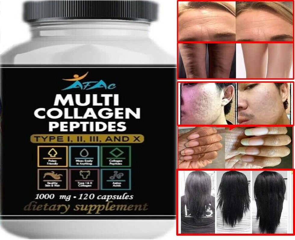 COLLAGEN Hydrolyzed 100% PURE BONES Health, HAIR, SKIN and NAILS 120