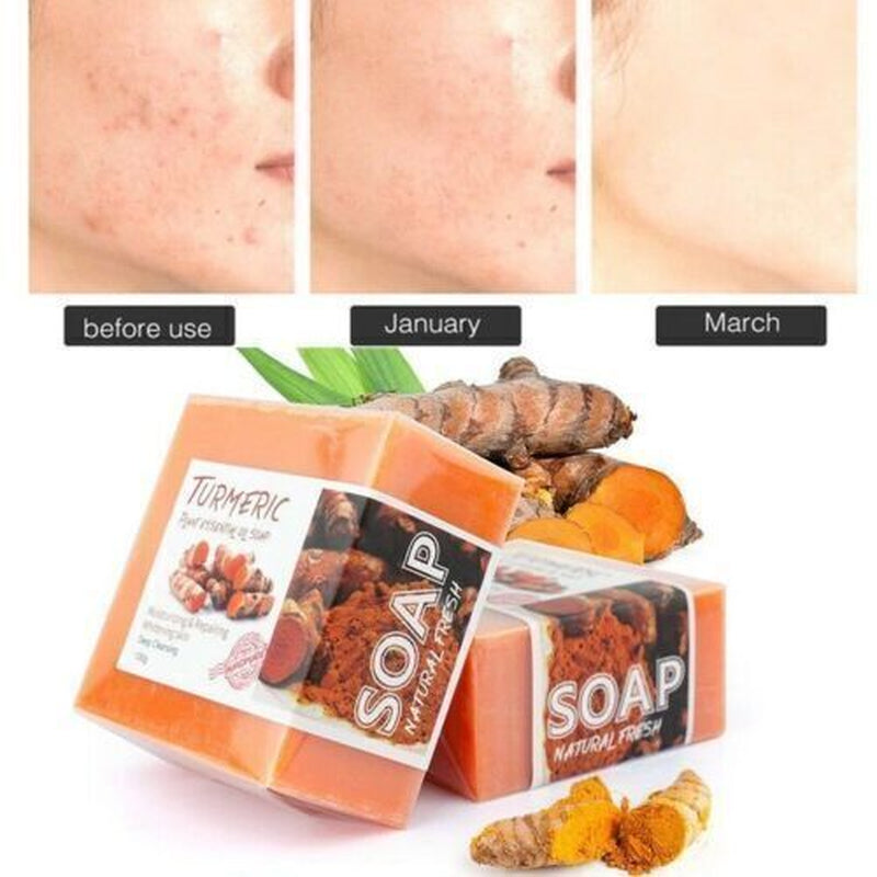 Tumeric Soap Skin Whitening Dark Spots Lightening Acne Brightening Turmeric