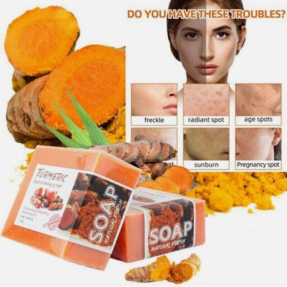 Tumeric Soap Skin Whitening Dark Spots Lightening Acne Brightening Turmeric