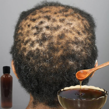 Traction Alopecia Treatment Hair Growth Chebe Shampoo