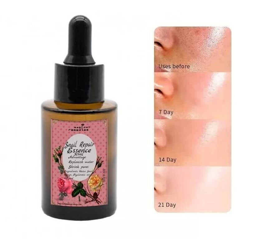 Snail Mucin, 96% Revitalizing Essence, Moisturizing Face Serum with Snail Secret