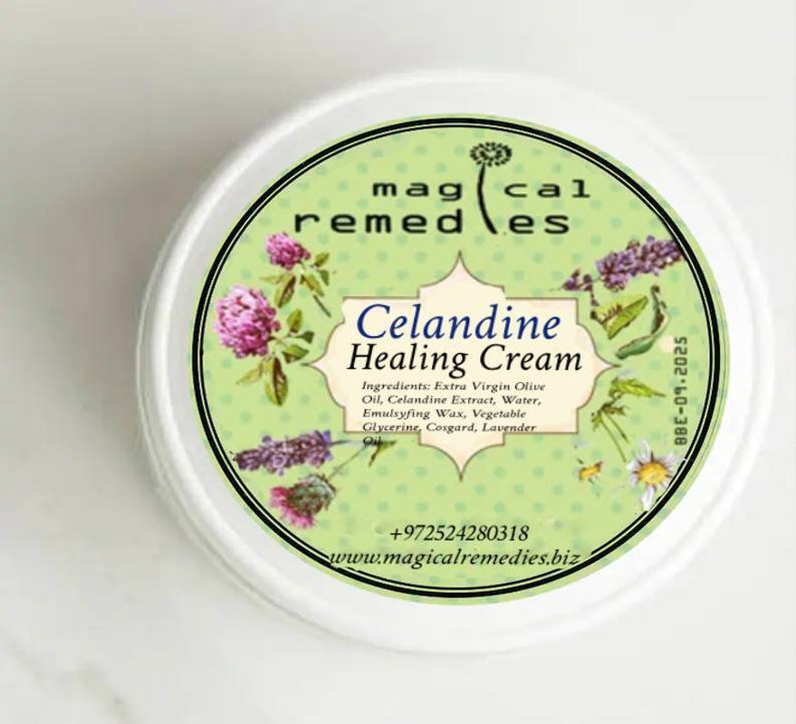 Celandine Healing Cream .Wonderful Way to Treat Skin Diseases