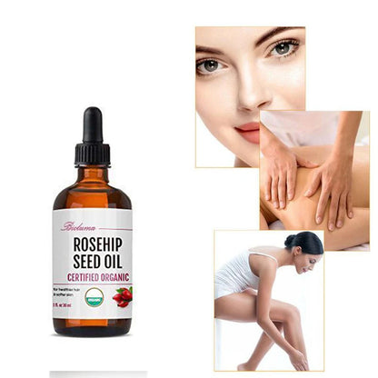 Rosehip Seed Oil Powerfully Whitens and Moisturizes Skin