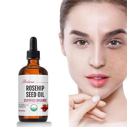 Rosehip Seed Oil Powerfully Whitens and Moisturizes Skin