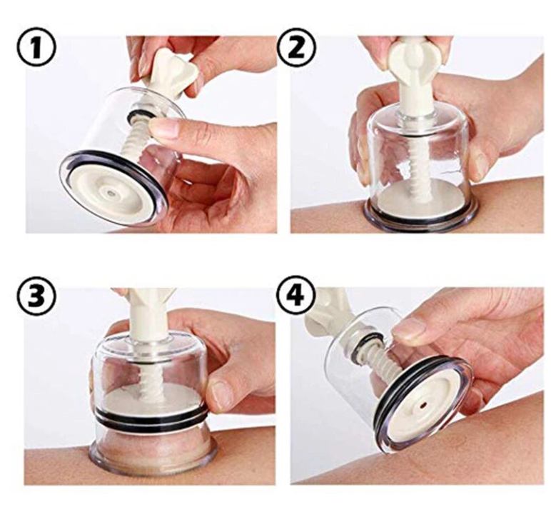 Manual Cupping Device