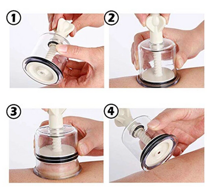 Manual Cupping Device