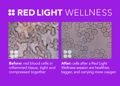 Whole Body Red Light Therapy 7200 (Clinic or Spa Quality)