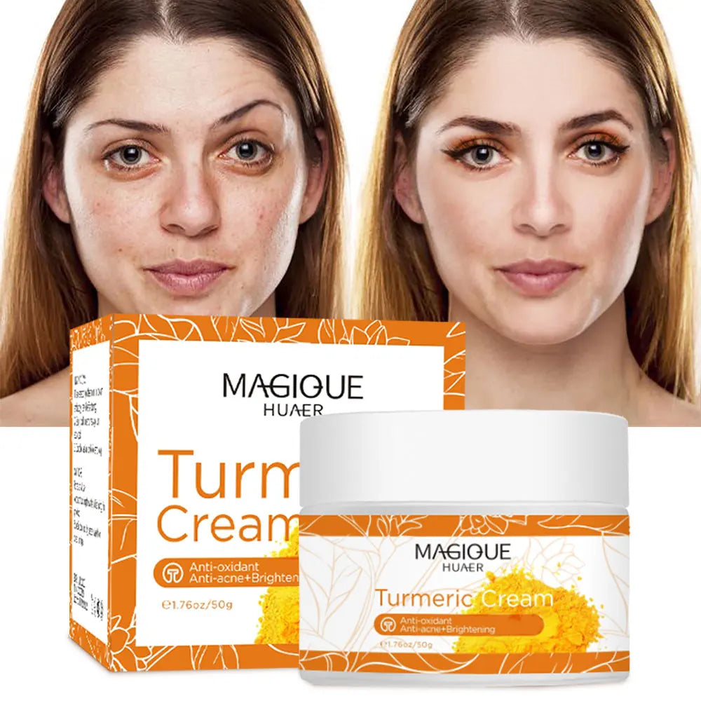 Whitening Cream Natural Organic Freckle Turmeric Cream Dark Spot Remover for Face Anti-Acne Moisturizer Brightening Skin Care