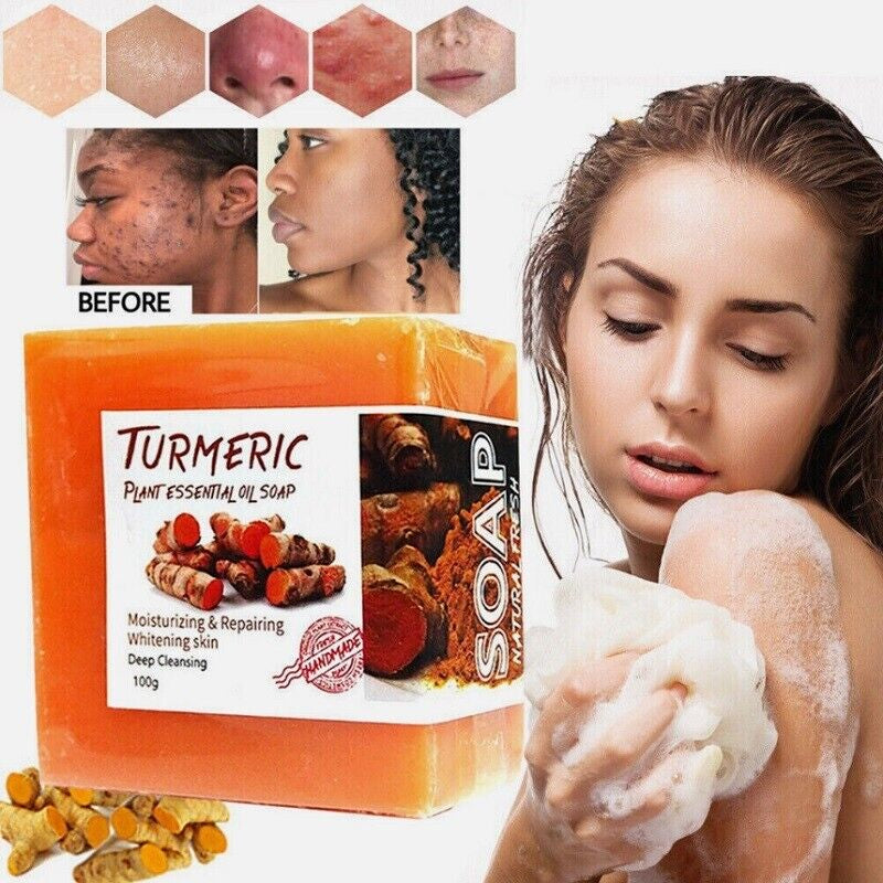 Tumeric Soap Skin Whitening Dark Spots Lightening Acne Brightening Turmeric