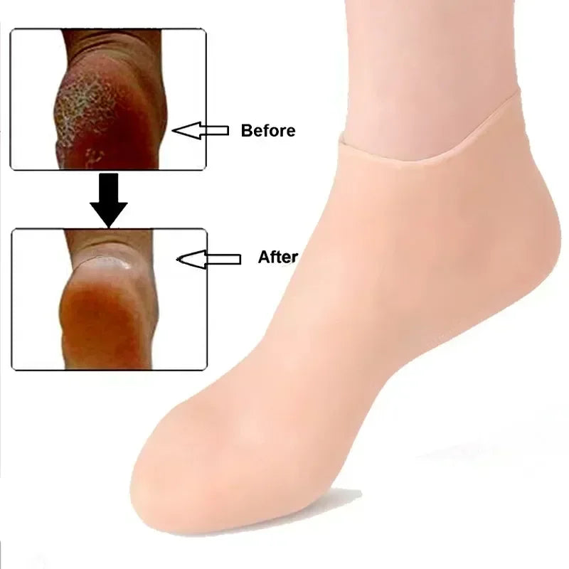 Reusable and Refillable Foot Poultice Detox Treatment Spa Gel Socks (Great with castor oil)