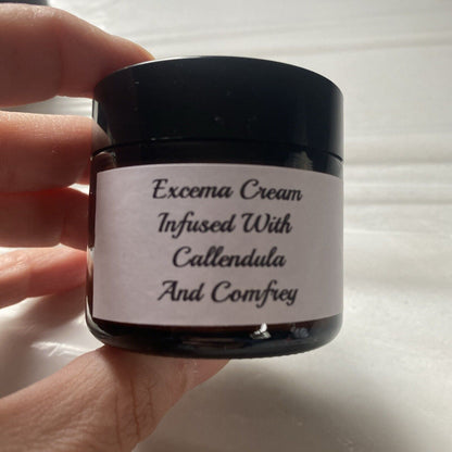 Treatment Cream for Eczema Psoriasis Infused with Comfrey Callendula