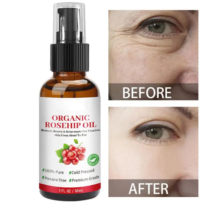 Rosehip Oil Organic Rose Hips Face Oils 30Ml