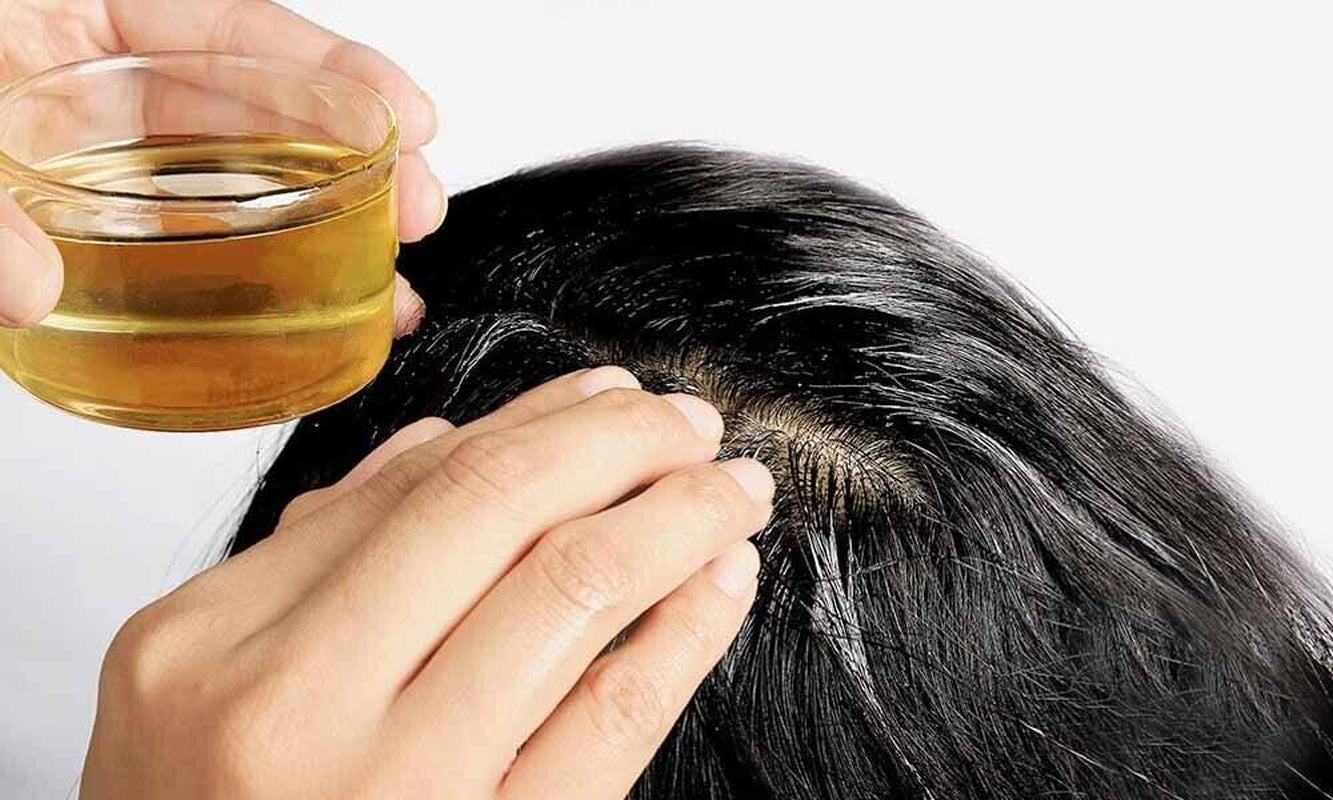 Seborrheic Dematitis Hair Oil-Relief-Ecz