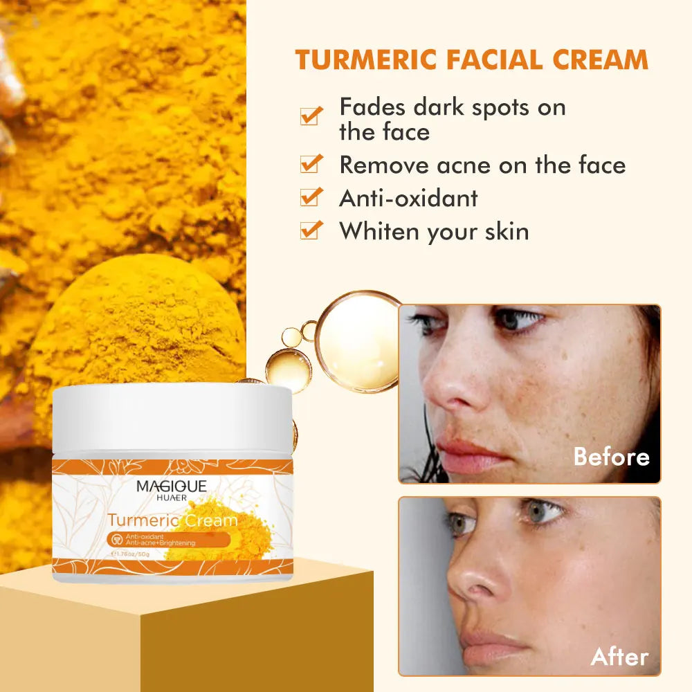 Whitening Cream Natural Organic Freckle Turmeric Cream Dark Spot Remover for Face Anti-Acne Moisturizer Brightening Skin Care