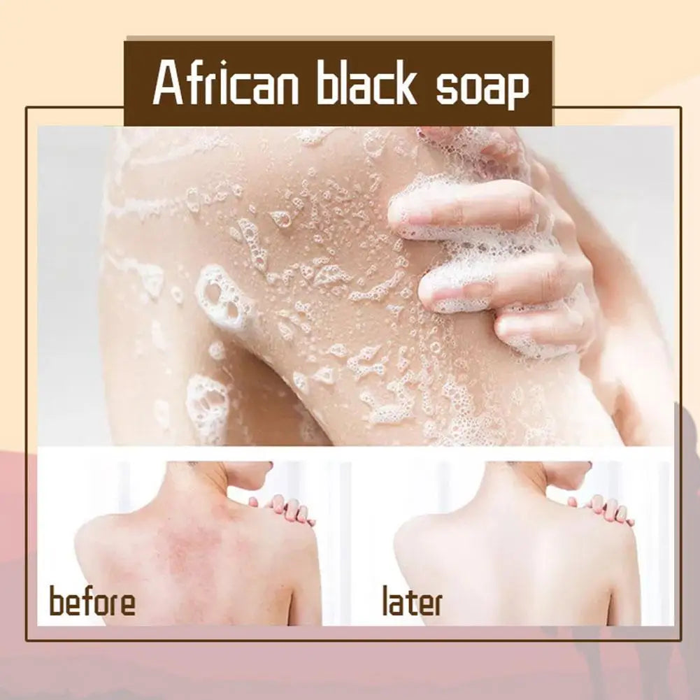 African Black Soap Hand Made