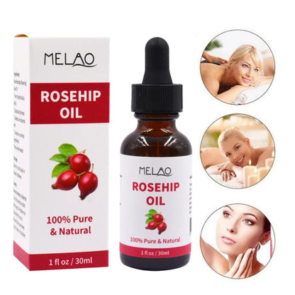 Organic Rosehip Seed Oil  Cold Pressed Facial Oil