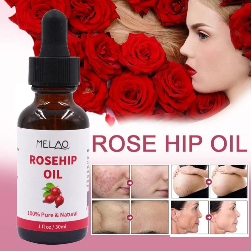 Organic Rosehip Seed Oil  Cold Pressed Facial Oil