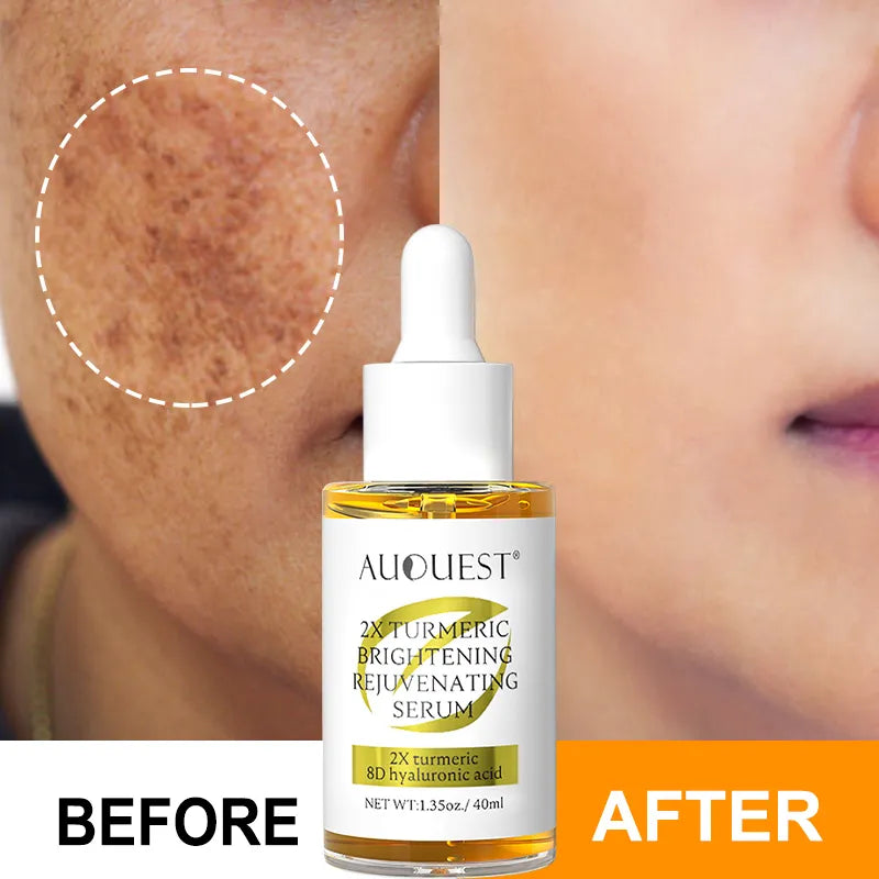 Turmeric Serum Brightening, Spot Fading, Antioxidant