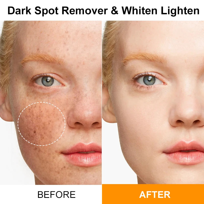 Turmeric Serum Brightening, Spot Fading, Antioxidant